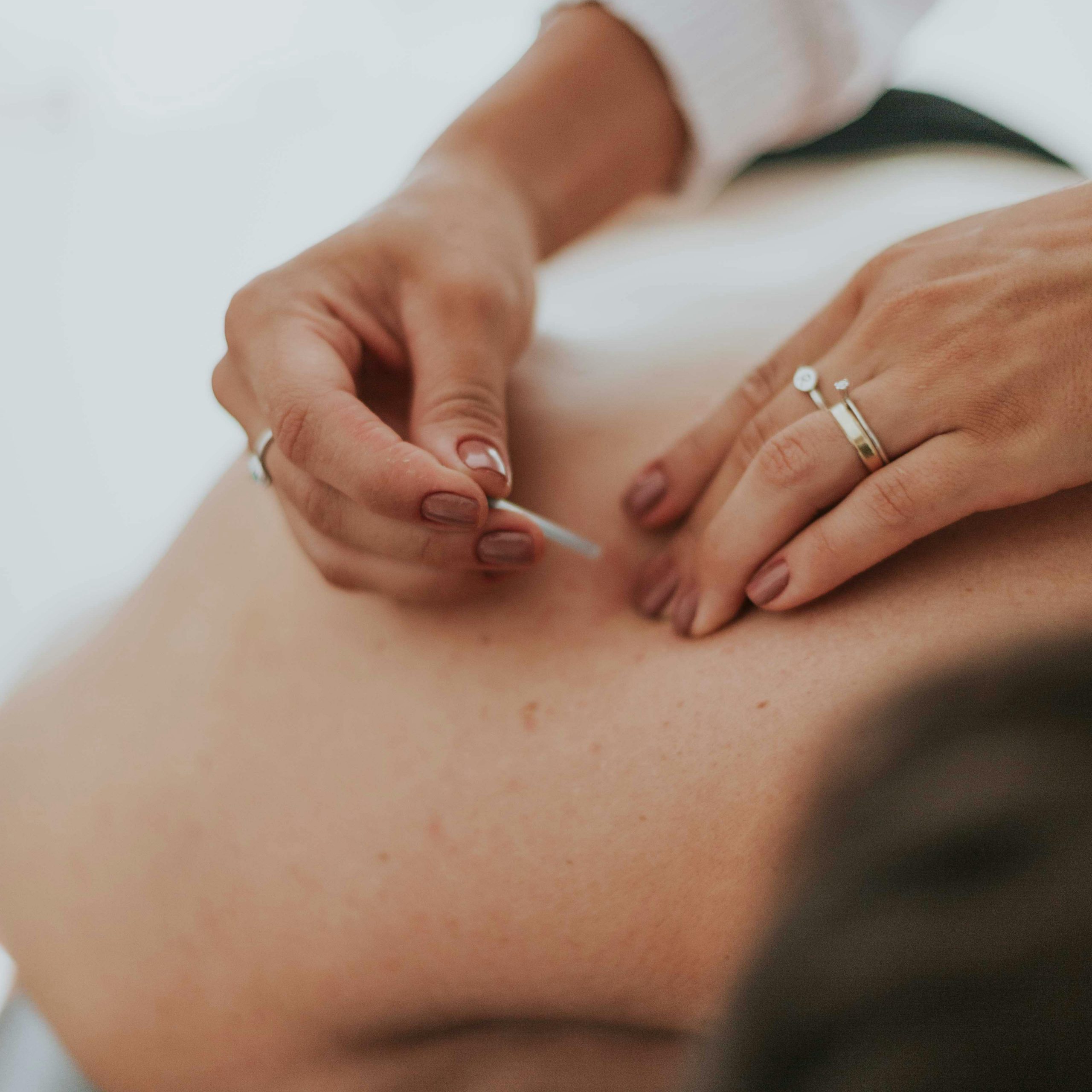 TCM Acupuncture Clinic in Orillia, Ontario